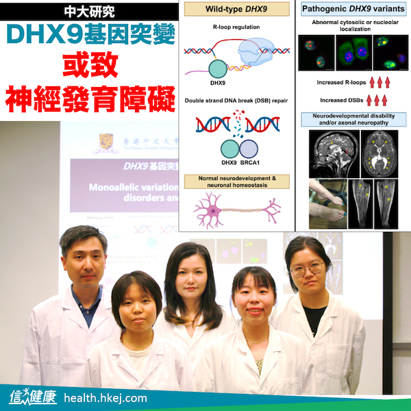 中大研究｜DHX9基因突變 或致神經發育障礙