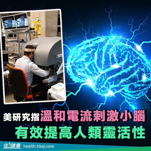 美研究指溫和電流刺激小腦  有效提高人類靈活性